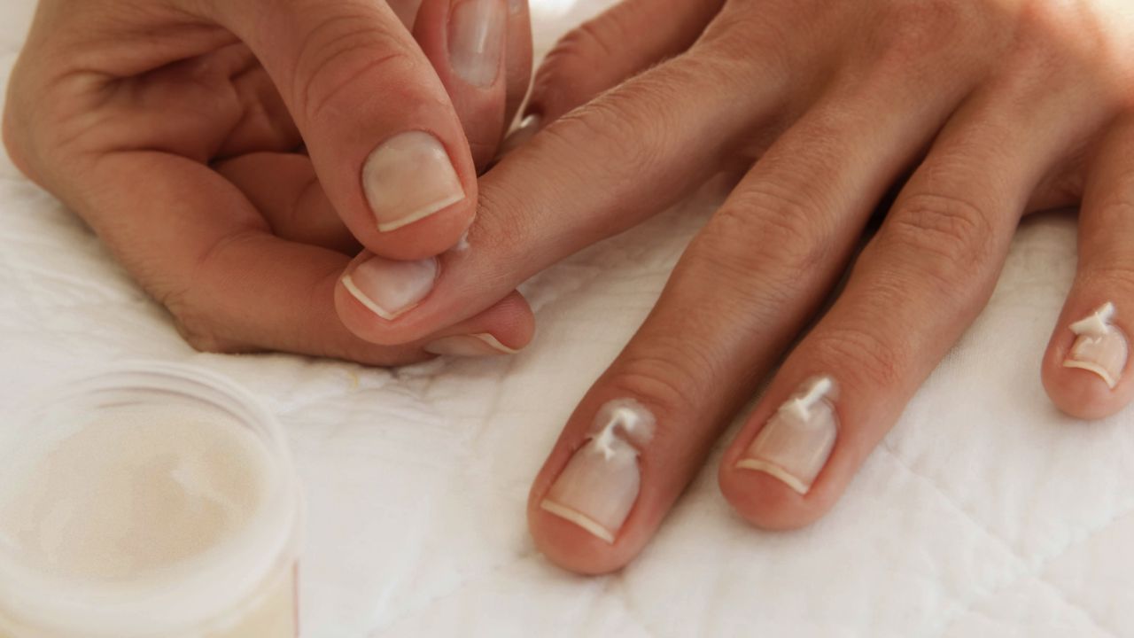 સ્વસ્થ આહાર લો: ત્વચા, શરીર અને વાળની સાથે નખને સ્વસ્થ રાખવા માટે સ્વસ્થ આહાર લેવો ખૂબ જ મહત્વપૂર્ણ છે. આ માટે તમે તમારા આહારમાં બાયોટિન અને પ્રોટીનથી ભરપૂર વસ્તુઓનો સમાવેશ કરી શકો છો. જેમ કે ઇંડા, બદામ, કઠોળ અને લીલા શાકભાજી. (Disclaimer: અહીં આપવામાં આવેલી માહિતી ફક્ત જાણકારી માટે જ છે. કોઈ પણ વસ્તુઓ અનુસરતા પહેલા તમારે તમારા ડોક્ટરની સલાહ અવશ્ય લેવી.)
