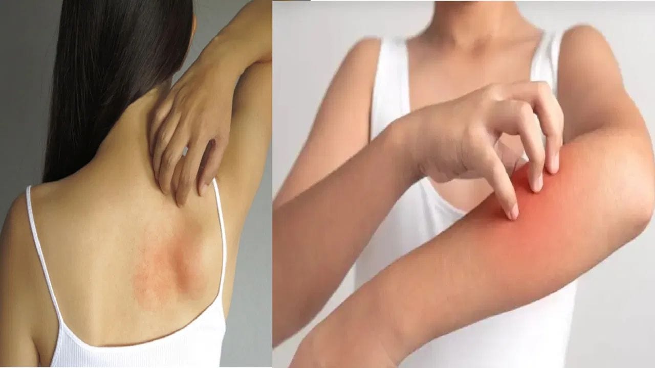 ત્વચાની સમસ્યાઓ - વિટામિન D ની ઉણપ ત્વચાની અન્ય સમસ્યાઓનું કારણ પણ બની શકે છે, જેમ કે ત્વચા પીળી પડવી, ત્વચા પર ફોલ્લીઓ અને ત્વચામાં બળતરા. જો તમને આમાંથી કોઈ સમસ્યા હોય, તો તમારે ડૉક્ટરનો સંપર્ક કરવો જોઈએ.