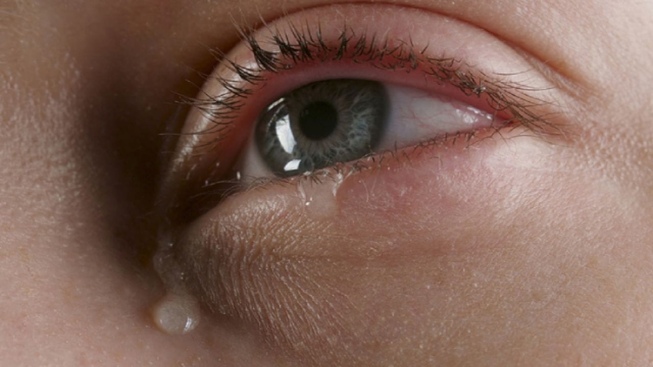 એલર્જીક નેત્રસ્તર દાહમાં પણ, ધૂળ, બાહ્ય કણો, ધુમાડો અથવા પાલતુ પ્રાણીઓની એલર્જીને કારણે આંખોમાં પાણી આવતું રહે છે. કેટલાક કિસ્સાઓમાં, ગ્લુકોમા, કોર્નિયલ ચેપ અથવા આંસુ નળીમાં અવરોધ પણ જવાબદાર હોઈ શકે છે. બાળકોમાં, જન્મથી જ આંસુની નળી બંધ થવાને કારણે પાણી આવે છે. જો આંખોમાં સતત પાણી આવતું રહે અને દુખાવો, ઝાંખી દ્રષ્ટિ અથવા પ્રકાશ વીંધવા જેવા લક્ષણો દેખાય, તો તાત્કાલિક ડૉક્ટરનો સંપર્ક કરો.