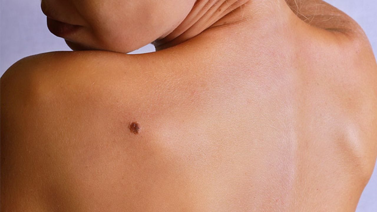 આ સ્થળોએ તલ શુભ છે: સામુદ્રિક શાસ્ત્રમાં એવું માનવામાં આવે છે કે જો કોઈ વ્યક્તિની છાતીની વચ્ચે તલ હોય તો તે ધનવાન હોવાનો સંકેત પણ આપે છે. આનો અર્થ એ છે કે દેવી લક્ષ્મીના આશીર્વાદ તમારા પર રહેશે. આ સાથે સામુદ્રિક શાસ્ત્રમાં એવું માનવામાં આવે છે કે પીઠ પર તલ રાખવાથી વ્યક્તિને નાણાકીય લાભ થાય છે. આ ઉપરાંત વ્યક્તિને ભવિષ્યમાં પૈસાની સમસ્યાનો સામનો કરવો પડતો નથી.
