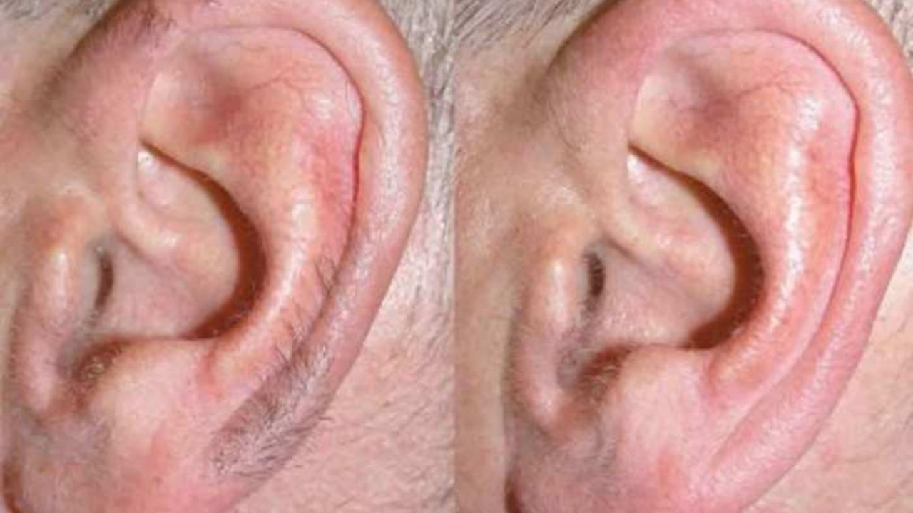 આજે આપણે એક ખાસ વિષય વિશે વાત કરીશું, એટલે કે કાન પર વાળનો વિકાસ. શું આ એક સામાન્ય શારીરિક લક્ષણ છે કે તેની પાછળ કોઈ ઊંડો અર્થ છુપાયેલ છે? શું આ કોઈ સારા નસીબની નિશાની છે કે ચેતવણી?
