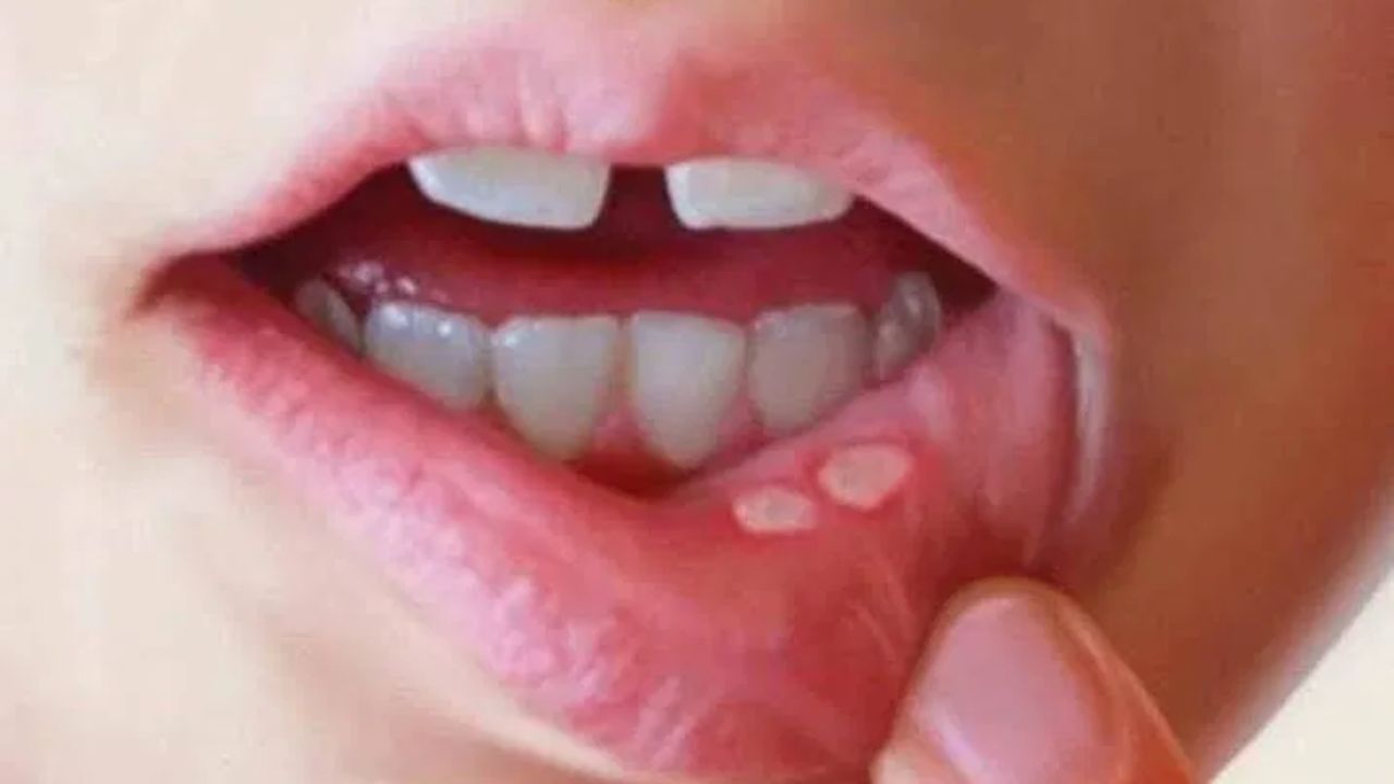 (નોંધ: આ લેખમાં આપેલી માહિતી અને ઉકેલો સામાન્ય સમજ પર આધારિત છે. અમે તેમને સમર્થન આપતા નથી. તેમને અપનાવતા પહેલા નિષ્ણાતની સલાહ લો.)