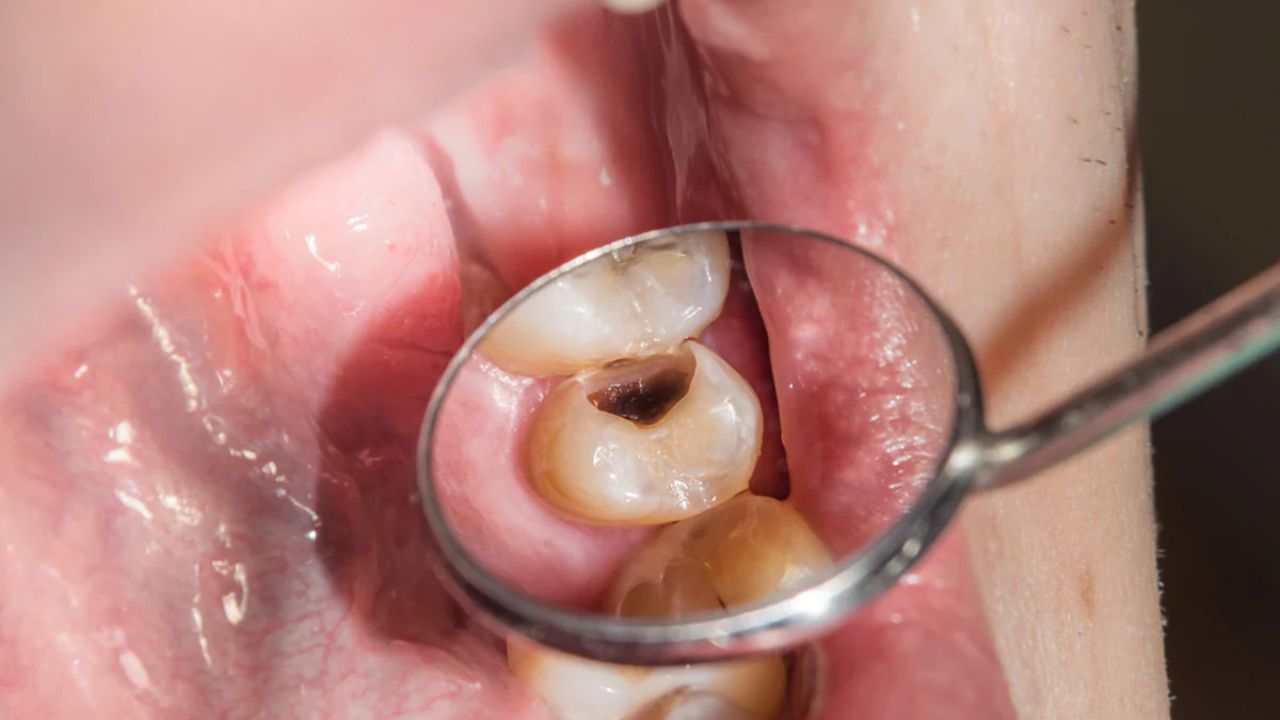 (નોંધ: આ લેખમાં આપેલી માહિતી અને ઉકેલો સામાન્ય સમજ પર આધારિત છે. અમે તેમને સમર્થન આપતા નથી. તેમને અપનાવતા પહેલા નિષ્ણાતની સલાહ લો.)