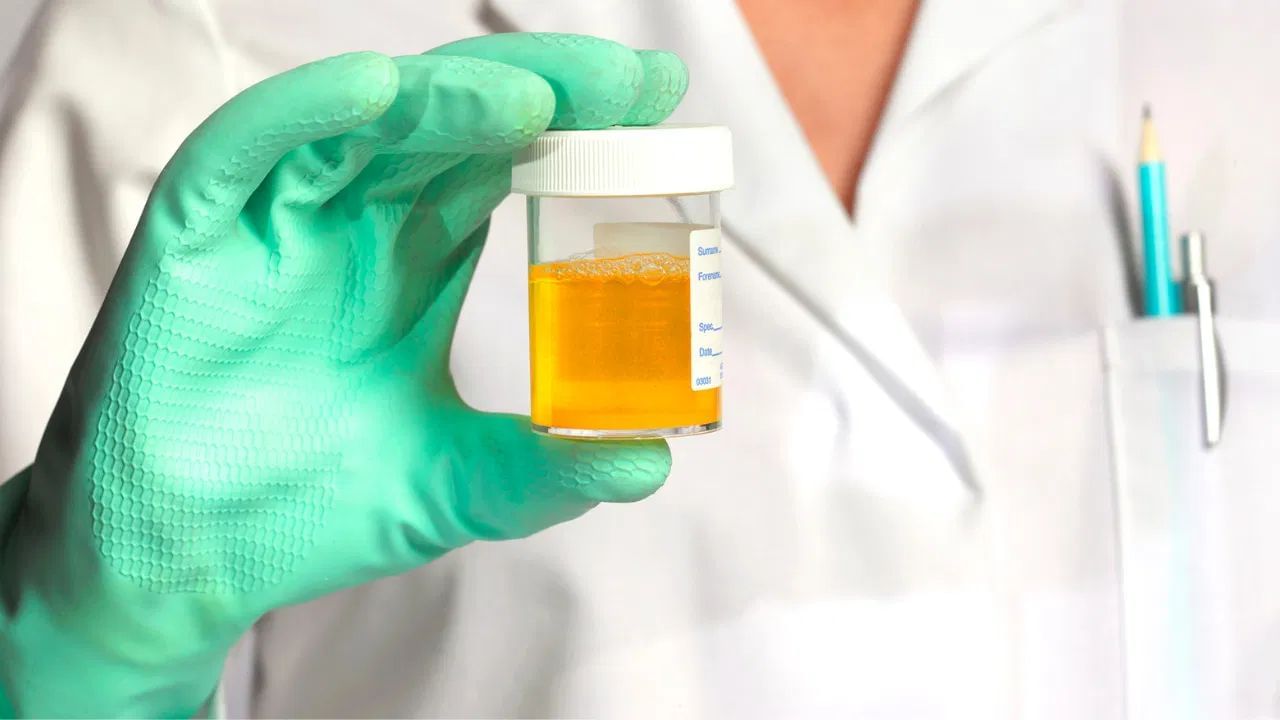 (નોંધ: આ લેખમાં આપેલી માહિતી અને ઉકેલો સામાન્ય સમજ પર આધારિત છે. અમે તેમને સમર્થન આપતા નથી. તેમને અપનાવતા પહેલા નિષ્ણાતની સલાહ લો.)