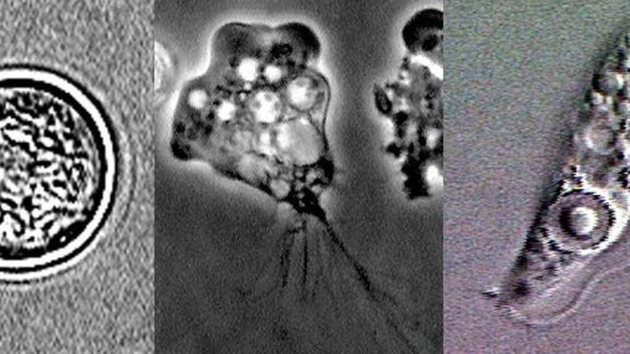 મળતી માહિતી મુજબ વધતા તાપમાનને કારણે આ એમોબિક મેનિન્જાઇટિસના કેસ વધી રહ્યા છે. નેગ્લેરિયા ફાઉલેરી અમીબાથી થતા આ ચેપની ઝડપી ગતિ અને અત્યંત ઘાતકતાને જોતાં નિષ્ણાતો પાણીની સલામતી અને આબોહવા સંબંધિત આરોગ્ય જોખમો વિશે માહિતી આપી રહ્યા છે અને સાવચેતી રાખવાની સલાહ આપી રહ્યા છે. હવે આવી સ્થિતિમાં દરેકના મનમાં પ્રશ્ન એ ઉઠી રહ્યો છે કે આ 'મગજ ખાનાર અમીબા' કેવી રીતે ફૂલીફાલી રહ્યો છે અને તેને કેવી રીતે ટાળી શકાય આ વિશે પણ જાણો.
