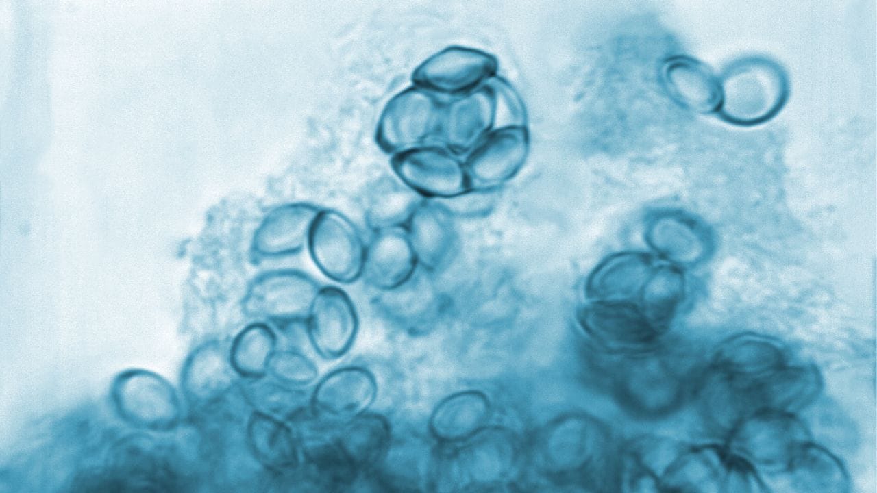 જો તમને લાંબા સમયથી કબજિયાત હોય અને પેટમાં દુખાવો, અનિયમિત પીરિયડ્સ, વારંવાર પેશાબ કરવાની ઇચ્છા, અથવા પેટમાં ગઠ્ઠો જેવી સમસ્યાઓનો અનુભવ થઈ રહ્યો હોય, તો તમારે તાત્કાલિક ડૉક્ટરનો સંપર્ક કરવો જોઈએ. 