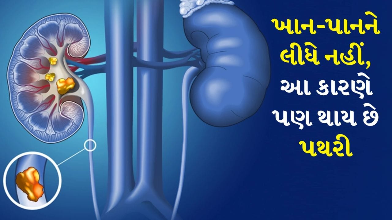 Kidney Stone: કિડની આપણા શરીરમાં એક મહત્વપૂર્ણ અંગ છે, જે લોહીને ફિલ્ટર કરે છે અને ઝેરી તત્વો અને વધારાનું પાણી દૂર કરે છે. આ પ્રક્રિયા પેશાબ ઉત્પન્ન કરે છે. કિડની શરીરમાં ખનિજો અને પ્રવાહીનું સંતુલન જાળવી રાખે છે જેથી સ્વસ્થ કામગીરી સુનિશ્ચિત થાય. જો કે જ્યારે પેશાબમાં વધુ પડતી માત્રામાં કેલ્શિયમ, ઓક્સાલેટ અથવા યુરિક એસિડ એકઠું થાય છે, ત્યારે તે સ્ફટિકીકરણ કરે છે અને ધીમે ધીમે કિડનીમાં પથરી બનાવે છે.