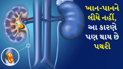 Kidney Stone: કિડની આપણા શરીરમાં એક મહત્વપૂર્ણ અંગ છે, જે લોહીને ફિલ્ટર કરે છે અને ઝેરી તત્વો અને વધારાનું પાણી દૂર કરે છે. આ પ્રક્રિયા પેશાબ ઉત્પન્ન કરે છે. કિડની શરીરમાં ખનિજો અને પ્રવાહીનું સંતુલન જાળવી રાખે છે જેથી સ્વસ્થ કામગીરી સુનિશ્ચિત થાય. જો કે જ્યારે પેશાબમાં વધુ પડતી માત્રામાં કેલ્શિયમ, ઓક્સાલેટ અથવા યુરિક એસિડ એકઠું થાય છે, ત્યારે તે સ્ફટિકીકરણ કરે છે અને ધીમે ધીમે કિડનીમાં પથરી બનાવે છે.
