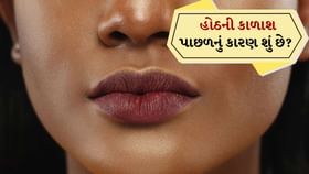 Skin care: હોઠ કાળા કેમ બની જાય છે? Skin care: હોઠ કાળા કેમ બની જાય છે?