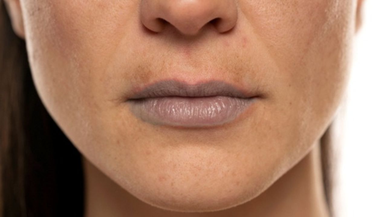 સનસ્ક્રીન ટાળવું: લોકો આખા ચહેરા પર સનસ્ક્રીન લગાવે છે, પરંતુ હોઠને અવગણે છે. તડકામાં બહાર જતા પહેલા સનસ્ક્રીન બામ લગાવવો જોઈએ, નહીં તો યુવી કિરણોને કારણે હોઠ પર પિગમેન્ટેશન વધે છે.
