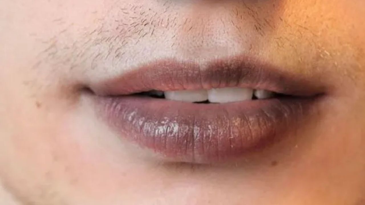 ધૂમ્રપાન કરવાની આદત: જો તમે પણ એવા લોકોમાંથી એક છો જેમને ધૂમ્રપાન કરવાની આદત છે, તો તેના કારણે તમારા હોઠ પર પિગમેન્ટેશન થઈ શકે છે અને તે ખૂબ કાળા થવા લાગે છે. આ એકંદર સ્વાસ્થ્યને નુકસાન પહોંચાડે છે, તેથી આ આદત છોડી દેવી જોઈએ.
