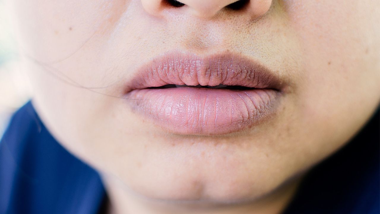 ખરાબ ખાવાની આદતો: દિવસની દિનચર્યા યોગ્ય રીતે ન રાખવી, જેમ કે ખરાબ ખાવાની આદતોને કારણે પોષક તત્વોનો અભાવ, પણ ત્વચા પર અસર કરે છે અને હોઠની ત્વચા શુષ્ક તેમજ કાળી પણ થઈ શકે છે.
