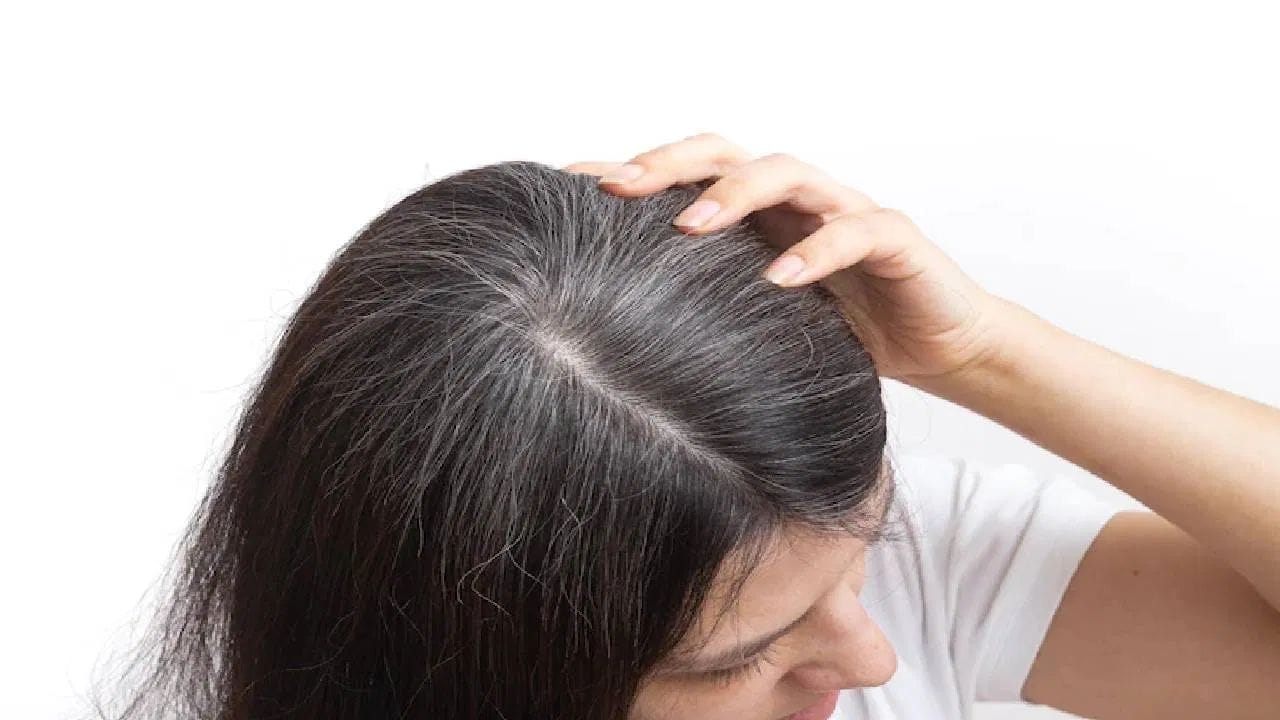 B12 થી ભરપૂર ખોરાક: આ વિટામિનની ઉણપને પહોંચી વળવા માટે, ઇંડા, દૂધ, દહીં, ચીઝ જેવા ડેરી ઉત્પાદનોનો આહારમાં સમાવેશ કરવો જોઈએ. તેમજ માંસાહારી ખોરાક જેમ કે માંસ અને માછલી પણ વિટામિન B12 નો સારો સ્ત્રોત છે. માંસાહારી ખાનારાઓ માટે આ એક ઉત્તમ વિકલ્પ છે.