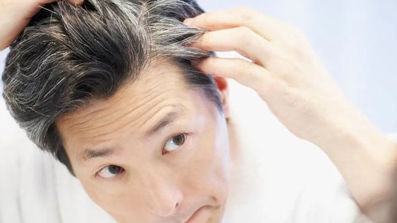 વિટામિન B12 ની ઉણપ અને વાળ સફેદ થવા - વિટામિન B12 વાળના સ્વાસ્થ્ય માટે ખૂબ જ મહત્વપૂર્ણ માનવામાં આવે છે. તે વાળના મૂળ એટલે કે વાળના ફોલિકલ્સને મજબૂત બનાવે છે. તેની ઉણપથી વાળ ખરવા અને સફેદ થવા લાગે છે.