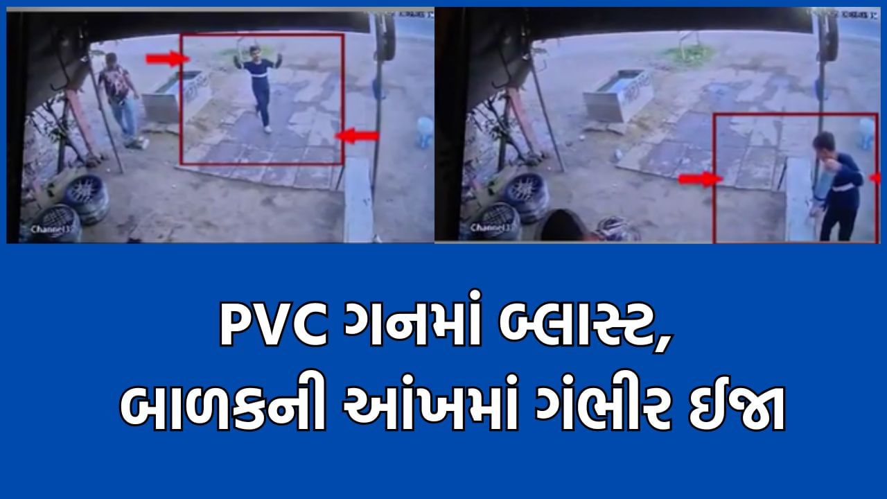 Amreli: ચલાલા ગામે પીવીસી પાઈપથી બનેલી ગનમાં ધડાકો થતા બાળકની આંખમાં આવી ગંભીર ઈજા- જુઓ Video