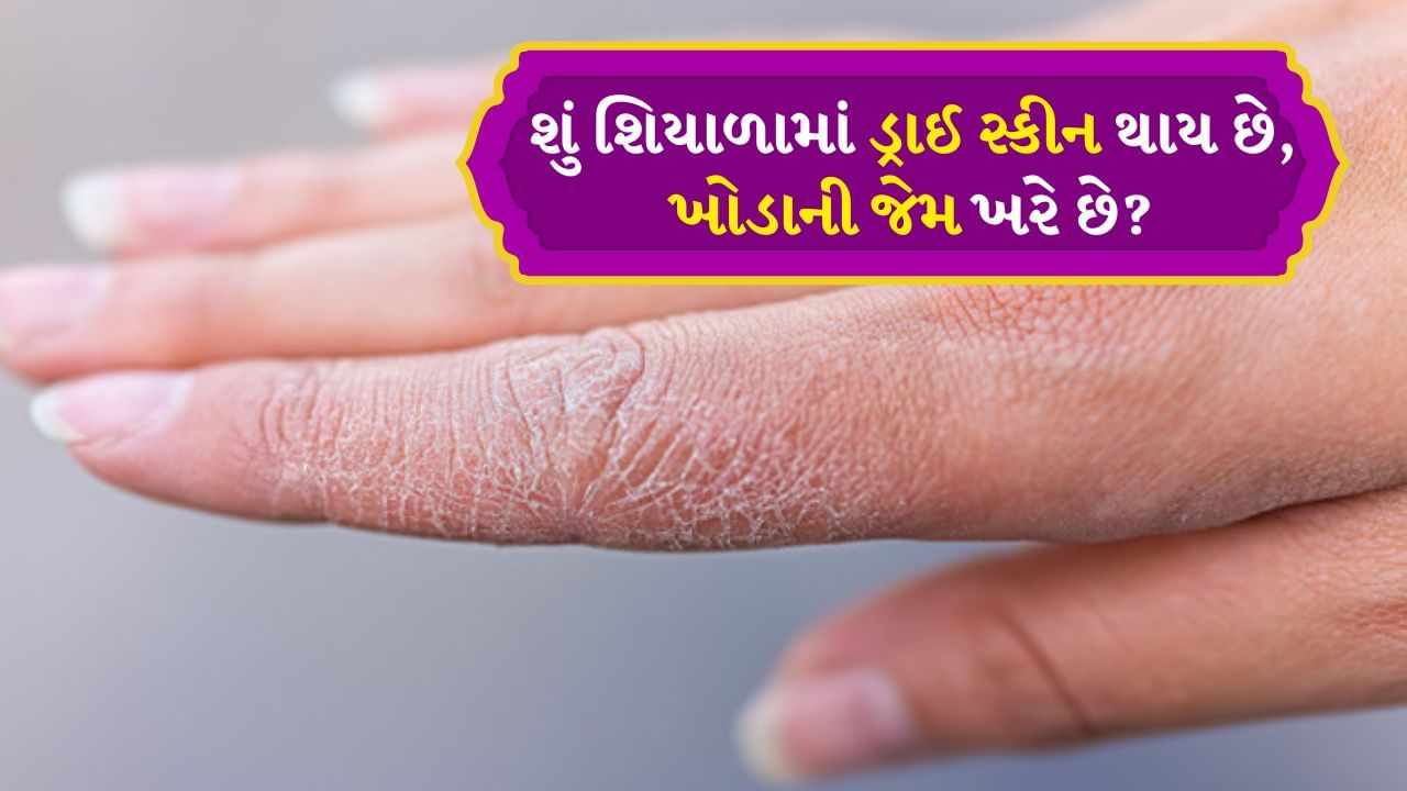 Dry skin Winter skin care