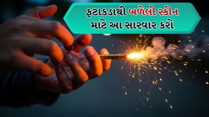 જો ફટાકડાથી સ્કીન બળી જાય તો શું કરવું?