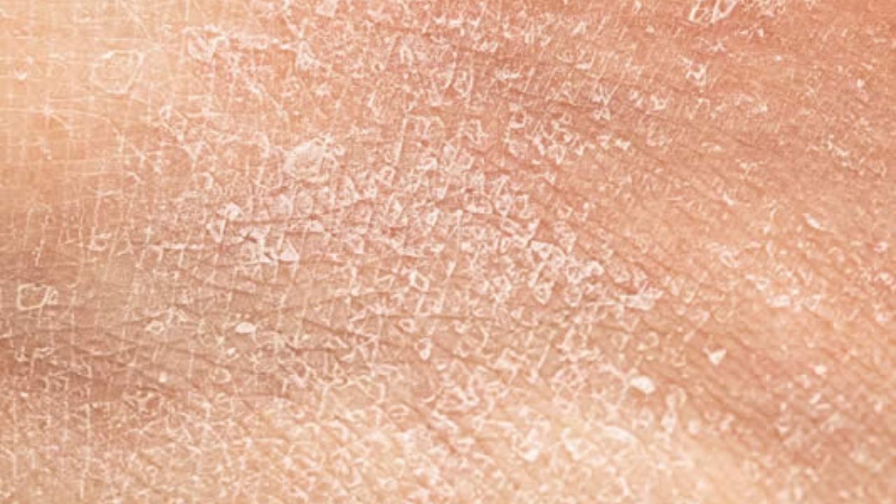 મોટાભાગના લોકો તેમના ચહેરા, હાથ અને પગની ત્વચા પર ધ્યાન આપે છે પરંતુ તેઓ પીઠ અને પેટ જેવા વિસ્તારોને અવગણે છે. જેના કારણે ભેજનું પ્રમાણ ઘટી શકે છે અને શિયાળામાં શુષ્કતા વધુ ખરાબ થઈ શકે છે. તમારી દિનચર્યામાં સકારાત્મક ફેરફારો કરીને તમે હાઇડ્રેશન જાળવી શકો છો. વધુમાં શુષ્કતાને રોકવા માટે બાહ્ય ત્વચાની સંભાળ પણ જરૂરી છે.