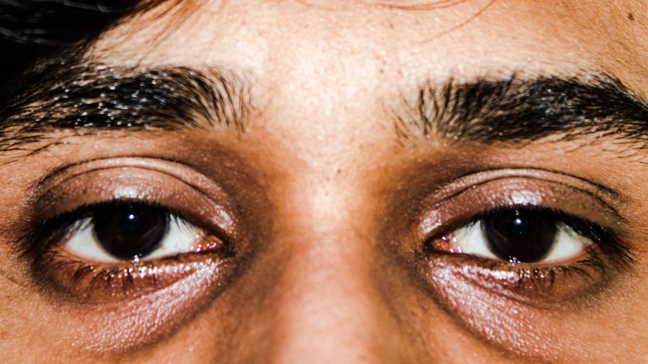 भले ही आप पूरे 8 घंटे की नींद ले रहे हों, अगर आपको गहरी नींद नहीं आ रही है, तो इससे भी डार्क सर्कल्स हो सकते हैं। इस समस्या से निपटने के लिए, स्क्रीन टाइम कम करें और सोने से पहले गर्म पानी से नहाएँ।