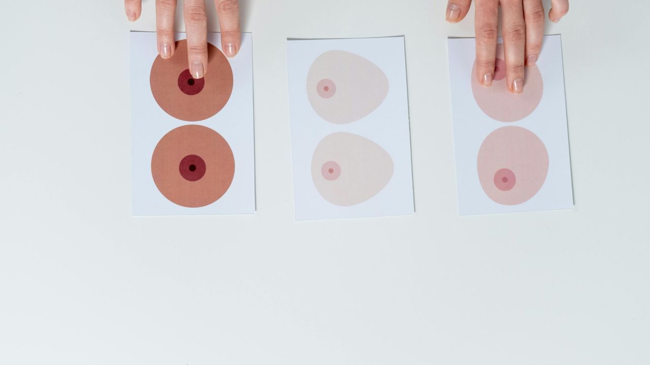 कभी-कभी हार्मोन्स में बदलाव के कारण स्तन संबंधी समस्याएं हो जाती हैं। स्तन में दर्द, स्तन में गांठ, स्तन की त्वचा में बदलाव, निप्पल में खुजली।