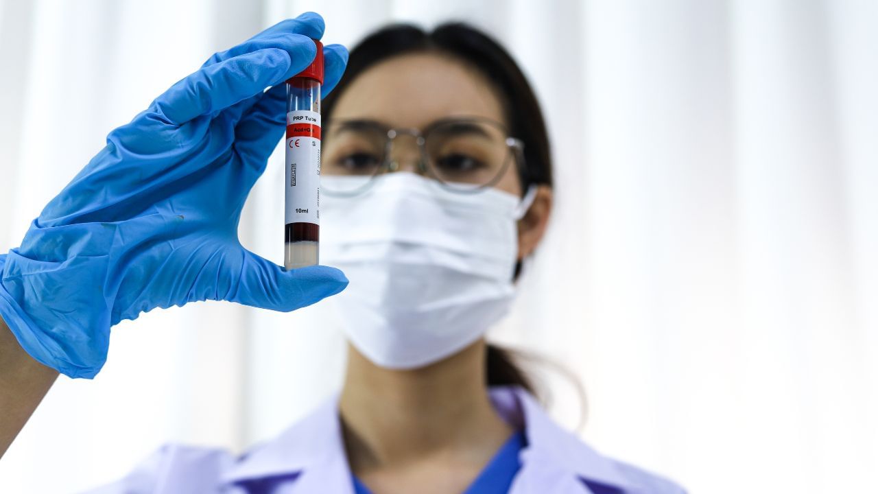  ઓછું પાણી પીવું, વધારે માત્રામા મસાલેદાર ફુડનું સેવન કરવું, લાંબા સમયસુધી અંડરગાર્મેન્ટ ચેન્જ ન કરવા  કે પછી કોઈ દવાની સાઈડઈફેક્ટના કારણે આવું થઈ શકે છે. પેશાબમાં થનારી આ બળતર જો એક- બે દિવસમાં યોગ્ય ન થઈ તો કોઈ ગંભીર બિમારી કે ઈન્ફેક્શનનો સંકેત હોય શકે છે.