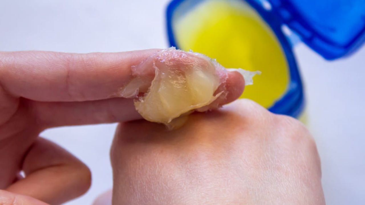 જ્યારે લોકો સામાન્ય રીતે ફાટેલા હોઠને સુધારવા માટે વેસેલિનનો ઉપયોગ કરે છે, ત્યારે તમને ખ્યાલ નહીં હોય કે તે અતિ ઉપયોગી થઈ શકે છે. આ આર્ટિકલમાં અમે વેસેલિનના આવા પાંચ ઉપયોગો શેર કરવા જઈ રહ્યા છીએ જે શિયાળાની ઋતુમાં ખૂબ ઉપયોગી થઈ શકે છે.
