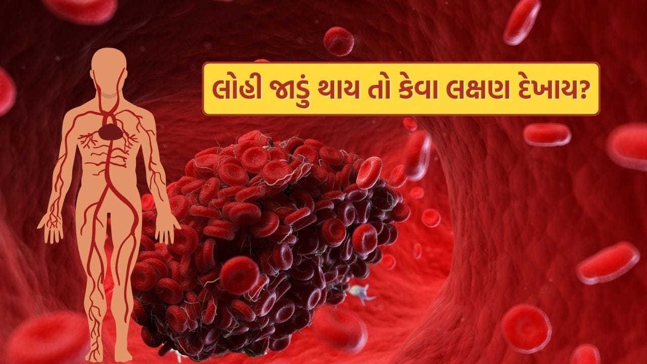 લોહી જાડું થવાના ઘણા લક્ષણો દેખાઈ શકે છે. તેથી, આ લક્ષણોને અવગણવા જોઈએ નહીં.