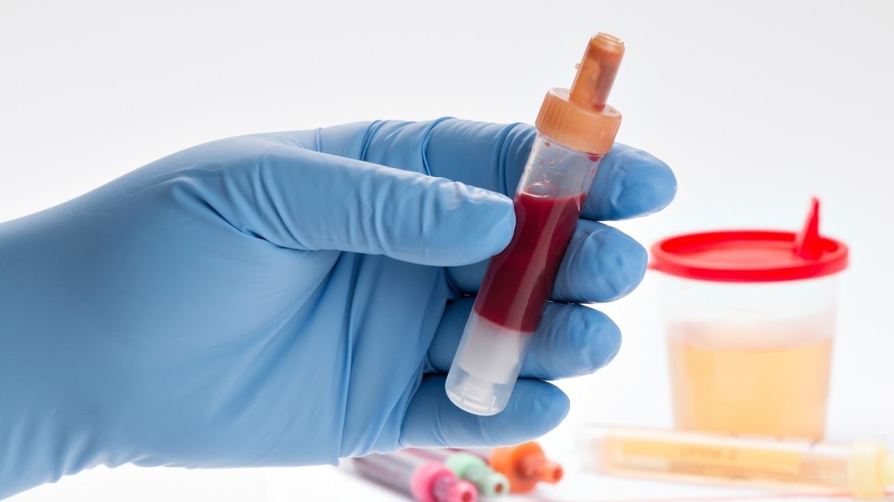 લોહી જાડું થવાને કારણે, આંખોને પૂરતો ઓક્સિજન મળતો નથી. આનાથી ઝાંખી દ્રષ્ટિ અથવા દ્રષ્ટિ ગુમાવવા જેવી સમસ્યાઓ થઈ શકે છે.