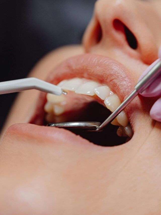 દાંતના સડાનું કારણ બની શકે છે આ સામાન્ય ભૂલો