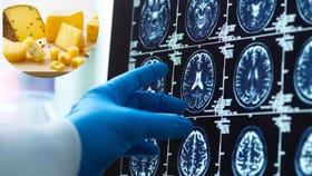 શું ચીઝ ખાવાથી ડિમેન્શિયાનું જોખમ ઓછું થાય છે? જાણો વિગતે