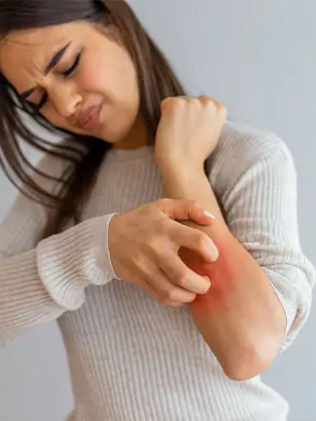 સ્કિન પર વારંવાર ખંજવાળ આવવી કઈ બીમારીના લક્ષણ છે?