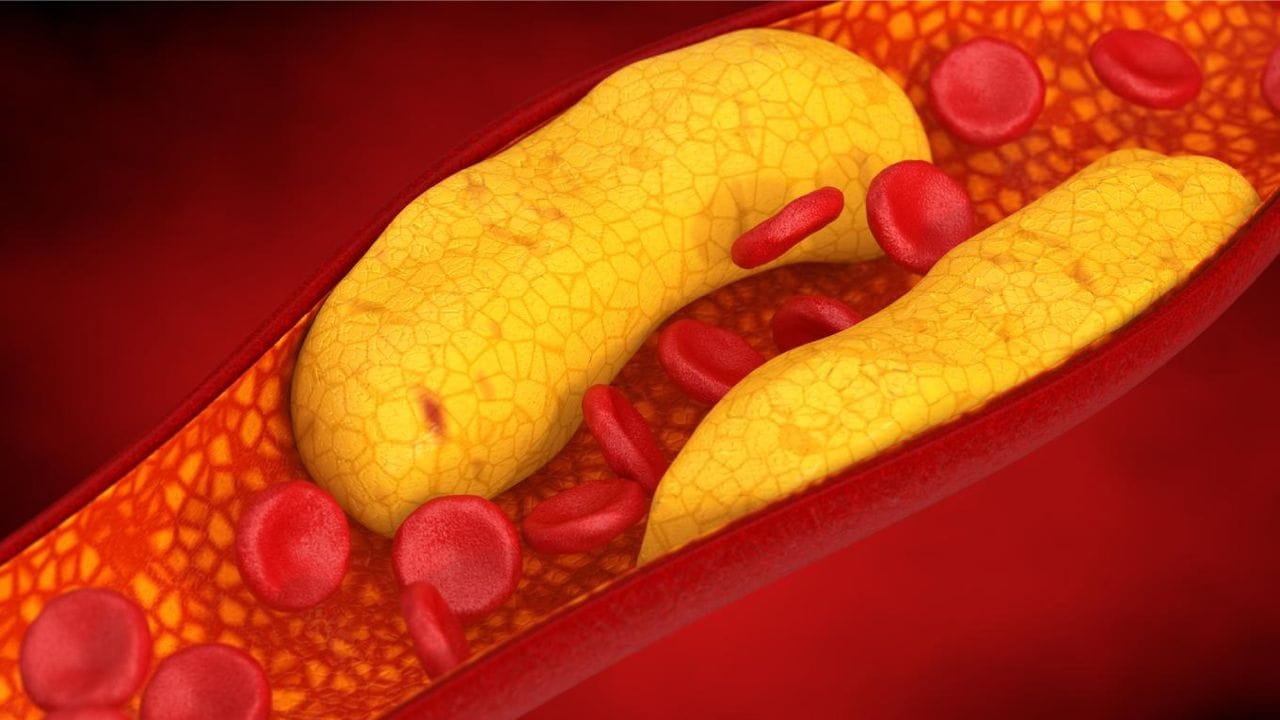 ફાઇબરયુક્ત ખોરાક ખાઓ: કોલેસ્ટ્રોલ ઓછું કરવા માટે ઓટ્સ, ઓટમીલ, સફરજન, નારંગી, સ્ટ્રોબેરી, બ્લુબેરી, લીલા પાંદડાવાળા શાકભાજી અને મસૂર જેવા ફાઇબરયુક્ત ખોરાક ખાઓ. કારણ કે તેમાં દ્રાવ્ય ફાઇબર હોય છે, જે કોલેસ્ટ્રોલને દૂર કરવામાં મદદ કરે છે.