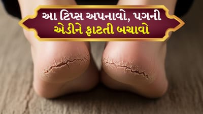 ઠંડી ઋતુમાં આપણી ત્વચા સૌથી વધુ ડ્રાઈ થઈ જાય છે. ખાસ કરીને એડીઓ પર જ્યાં ત્વચા જાડી હોય છે અને ભેજના અભાવે ઝડપથી તિરાડ પડે છે. શરૂઆતમાં તે ડ્રાયનેસ જેવું લાગે છે, પરંતુ જો ધ્યાન ન આપવામાં આવે તો ફાટવાની સમસ્યા વધુ બને છે, જેના કારણે ચાલતી વખતે દુખાવો થાય છે અને ક્યારેક લોહી પણ નીકળે છે. થોડી નિયમિત સંભાળ, યોગ્ય સફાઈ અને મોઇશ્ચરાઇઝિંગથી એડીઓ નરમ, સ્વચ્છ અને સુંદર થઈ શકે છે.
