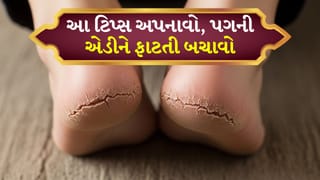 શિયાળો શરૂ થતાં જ પગની એડી ફાટી જાય છે ? સમસ્યા વધારે વધે તે પહેલાં આ કામ કરો