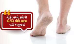 લોકો વચ્ચે ફાટેલી એડીને લીધે શરમ નહી અનુભવો, આ ટ્રિક્સનો ઉપયોગ કરો અને મેળવો મુલાયમ એડી