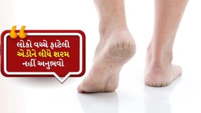 લોકો વચ્ચે ફાટેલી એડીને લીધે શરમ નહી અનુભવો, આ ટ્રિક્સનો ઉપયોગ કરો અને મેળવો મુલાયમ એડી
