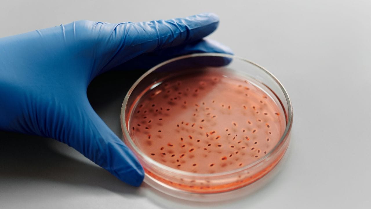 નોંધ : અહીં આપવામાં આવેલી માહિતી ફક્ત આપની જાણકારી માટે છે. કોઈ પણ ઈલાજ કરતાં પહેલા કે,અમલમાં લેતા પહેલા નિષ્ણાતોની સલાહ લેવી જરુરી છે. ( all photo:canva)