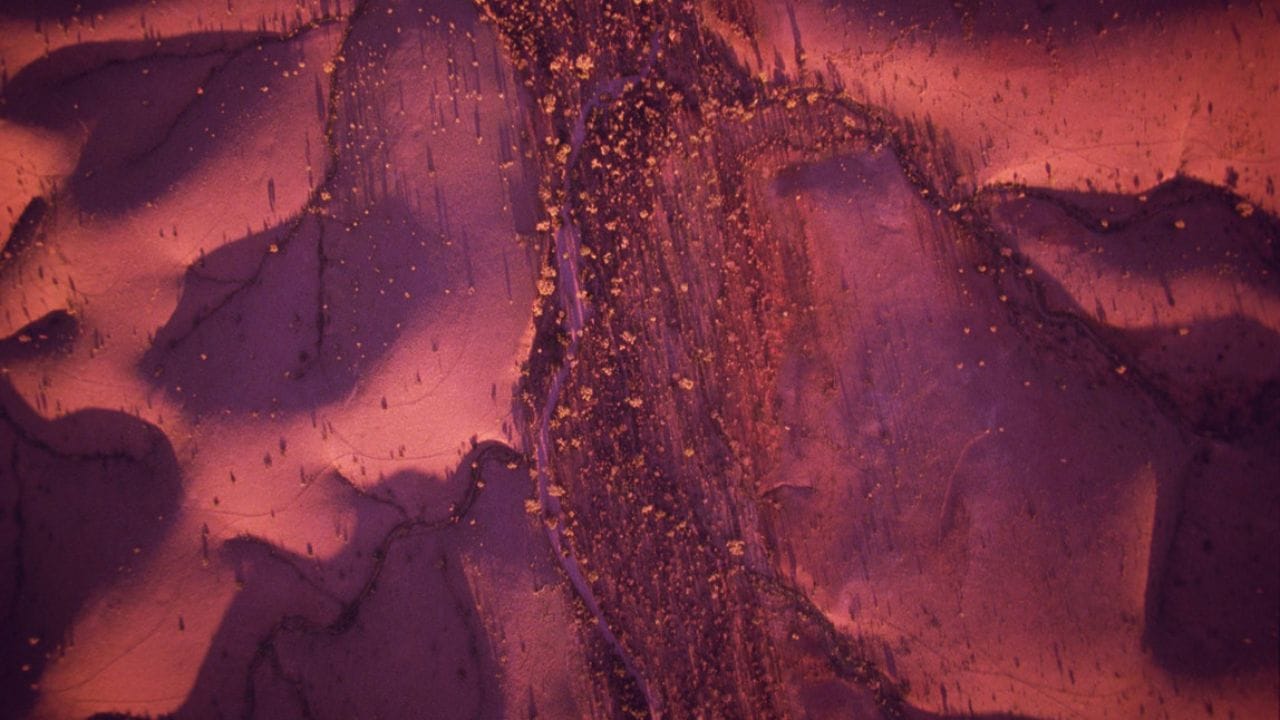 એન્ડોમેટ્રિયોસિસ એક એવી સમસ્યા છે. જેમાં ગર્ભાશયની પરત ટિશ્યુ ગર્ભાશયની બહાર એટલે કે, ફેલોપિયન ટ્યુબ અને અંડાશય પર વધવા લાગે છે. એન્ડોમીટ્રિઓસિસ થવા પર ઓવરી, ફેલોપિયન ટ્યુબઅથવા આંતરડા પર પેશી મળી શકે છે, જે ફેલોપિયન ટ્યુબના અવરોધને કારણે થઈ શકે છે.