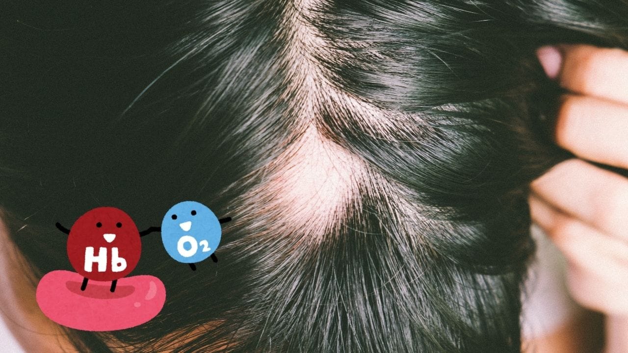 હિમોગ્લોબિન વધારવા માટે આયર્ન જરૂરી છે, જે વાળના ફોલિકલ્સને ઓક્સિજન પૂરો પાડે છે. જ્યારે પૂરતો ઓક્સિજન પુરવઠો પૂરતો ન હોય ત્યારે વાળ ખરવા લાગે છે. આનો સામનો કરવા માટે, મોરિંગા અને પાલક ખાઓ.