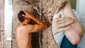 શિયાળામાં ચામડીના રોગોથી પીડાતા લોકોએ કેવી રીતે સ્નાન કરવું જોઈએ?