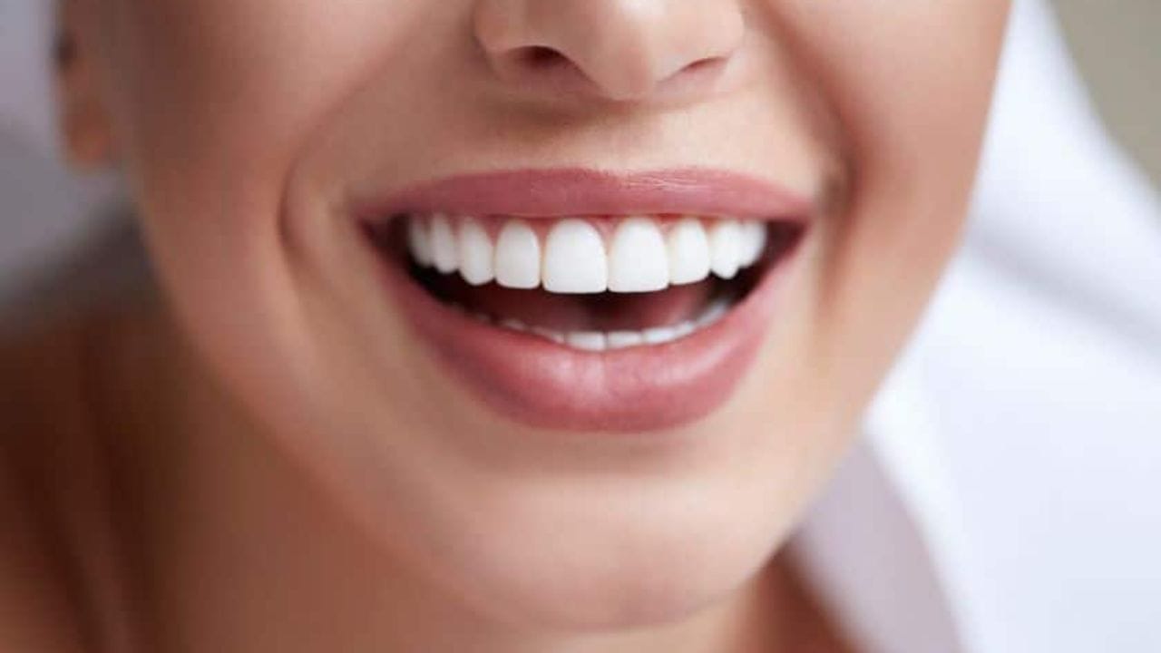 natural teeth whitening