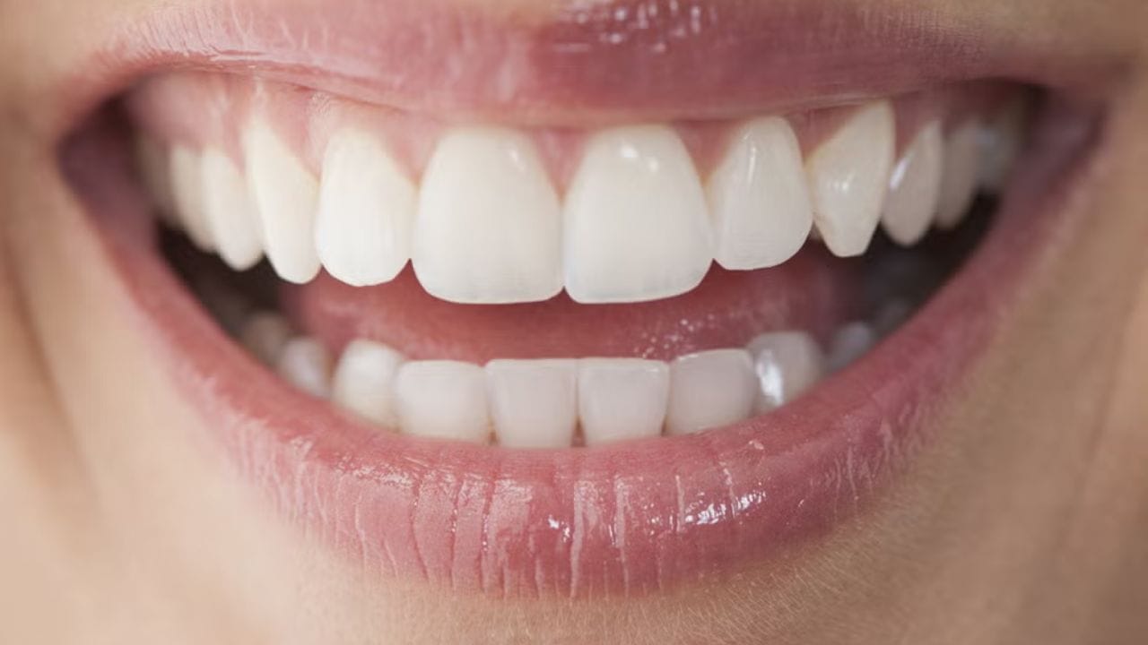 salt for teeth whitening