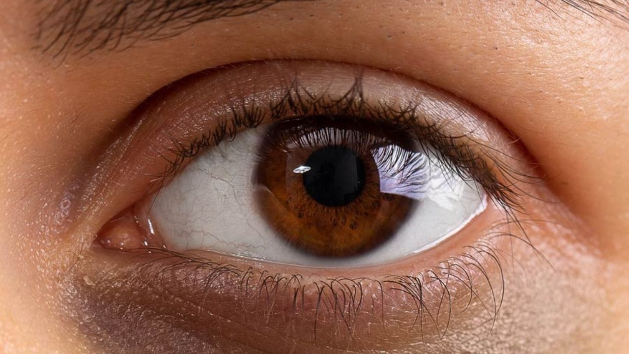 મોબાઇલ ફોન, લેપટોપ, મોડી રાત સુધી જાગવું અને બદલાતી જીવનશૈલીએ આ સમસ્યાને વધારી દીધી છે. ડાર્ક સર્કલ વિશે વિવિધ માન્યતાઓ પણ પ્રચલિત છે.