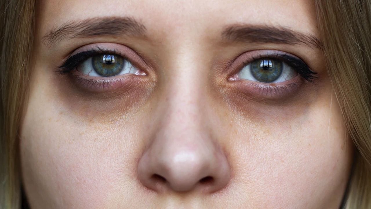 ક્રીમથી ડાર્ક સર્કલ ગાયબ થઈ જાય છે: નિષ્ણાતો કહે છે કે લોકો માને છે કે ક્રીમથી ડાર્ક સર્કલ ગાયબ થઈ જાય છે. પરંતુ આ સાચું નથી... તમારે તેને દૂર કરવા માટે ડાર્ક સર્કલનું કારણ સમજવાની જરૂર છે. તમે ફક્ત કોઈપણ ક્રીમ આડેધડ ન લગાવી શકો.