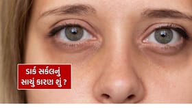 ડાર્ક સર્કલ સાથે જોડાયેલા એ Myths જે લોકો આસાનીથી માની જાય