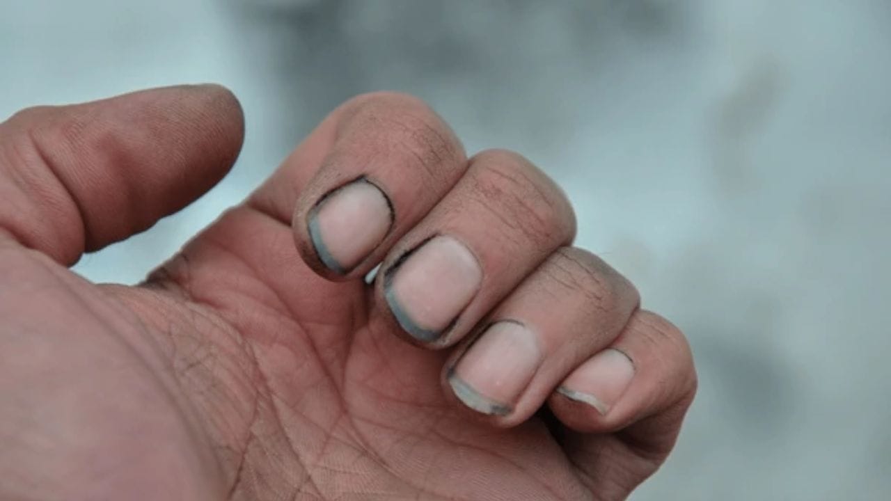 જ્યોતિષ અને સામુદ્રિક શાસ્ત્રમાં, નાની શારીરિક આદતો પણ ભાગ્ય સાથે જોડાયેલી છે. નખ માત્ર સ્વચ્છતાનું પ્રતીક માનવામાં આવતું નથી, પરંતુ તે ગ્રહોની ગતિવિધિઓ સાથે પણ જોડાયેલા છે. એવું માનવામાં આવે છે કે ગંદા, તૂટેલા અથવા ઉપેક્ષિત નખ જીવનમાં સતત અવરોધો ઉભા કરે છે. જ્યોતિષ શાસ્ત્ર અનુસાર, ખાસ કરીને એક ગ્રહ એવો છે જેનો પ્રભાવ ગંદા નખથી વધુ ખરાબ થાય છે. આના પરિણામે નિષ્ફળતા, માનસિક તણાવ અને ગરીબી આવે છે.