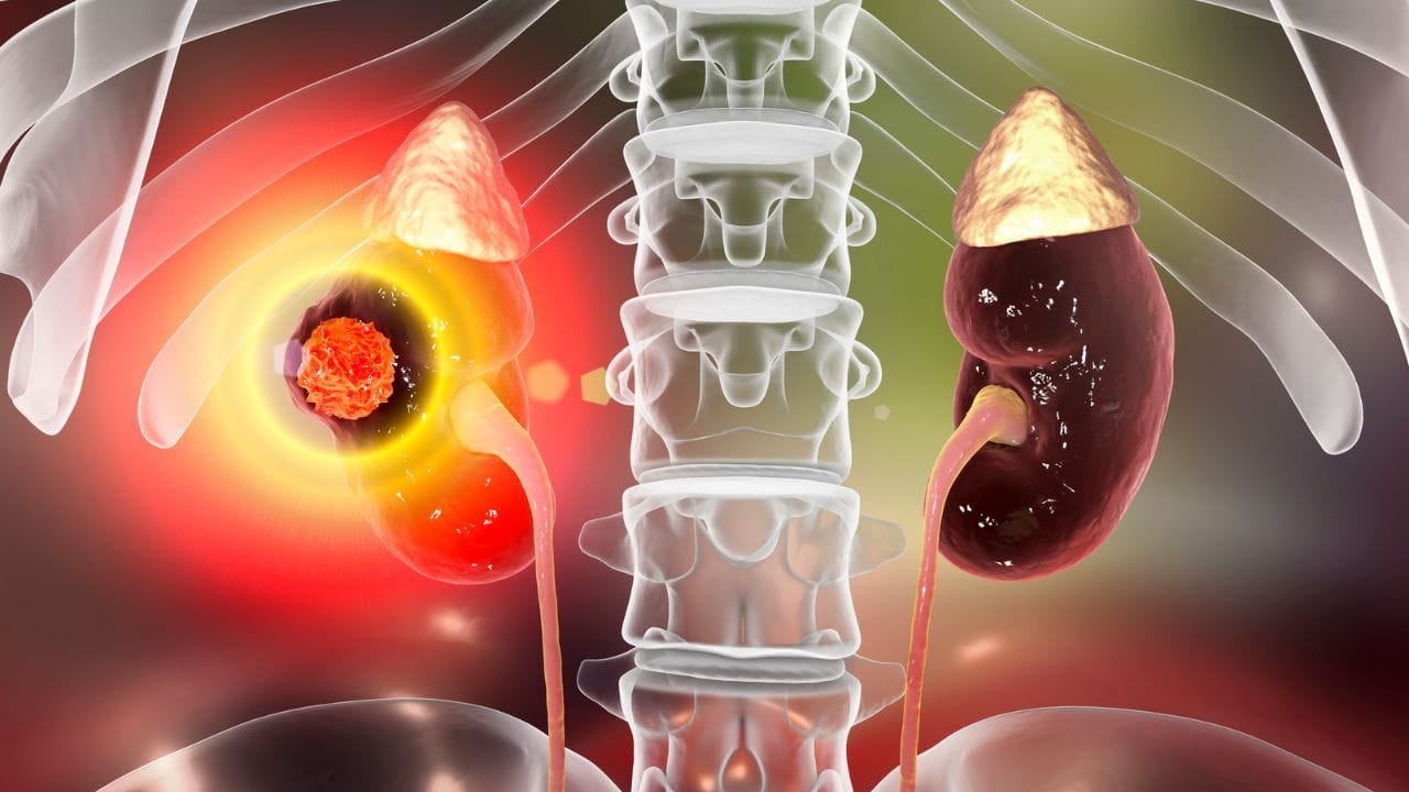 ફેટી લીવરથી થતો થાક સામાન્ય નબળાઈ કરતાં અલગ હોય છે. પૂરતો આરામ કર્યા બાદ પણ શરીરમાં ઉર્જાનો અભાવ અનુભવાય છે. લીવર ખોરાકમાંથી પોષક તત્વોને ઉર્જામાં ફેરવે છે, પરંતુ જ્યારે તેમાં ચરબી જમા થાય છે, ત્યારે આ પ્રક્રિયા ધીમી પડી જાય છે. પરિણામે, વ્યક્તિને દિવસભર સુસ્તી, ભારપણું અને સતત થાક લાગતો રહે છે. ઘણીવાર લોકો તેને તણાવ કે વધુ કામનું પરિણામ માનીને અવગણે છે, પરંતુ જો આ રોજિંદી સમસ્યા બની જાય, તો તેને ગંભીરતાથી લેવું જોઈએ.