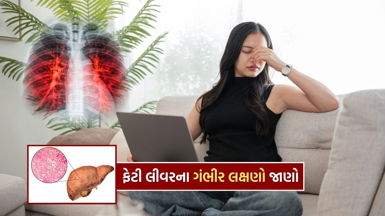 ભારતમાં બદલાતી જીવનશૈલી અને ખોરાકની ટેવને કારણે અનેક રોગો ઝડપથી ફેલાઈ રહ્યા છે, જેમાં ફેટી લીવર ડિસીઝ પણ સામેલ છે. અંદાજ મુજબ, દેશમાં લગભગ 38 ટકા પુખ્ત વયના લોકો નોન-આલ્કોહોલિક ફેટી લીવર ડિસીઝ (NAFLD) થી પ્રભાવિત થઈ શકે છે. સૌથી ચિંતાજનક બાબત એ છે કે આ રોગ શરૂઆતમાં કોઈ સ્પષ્ટ લક્ષણો બતાવતો નથી અને ધીમે ધીમે ગંભીર સ્વરૂપ ધારણ કરે છે.