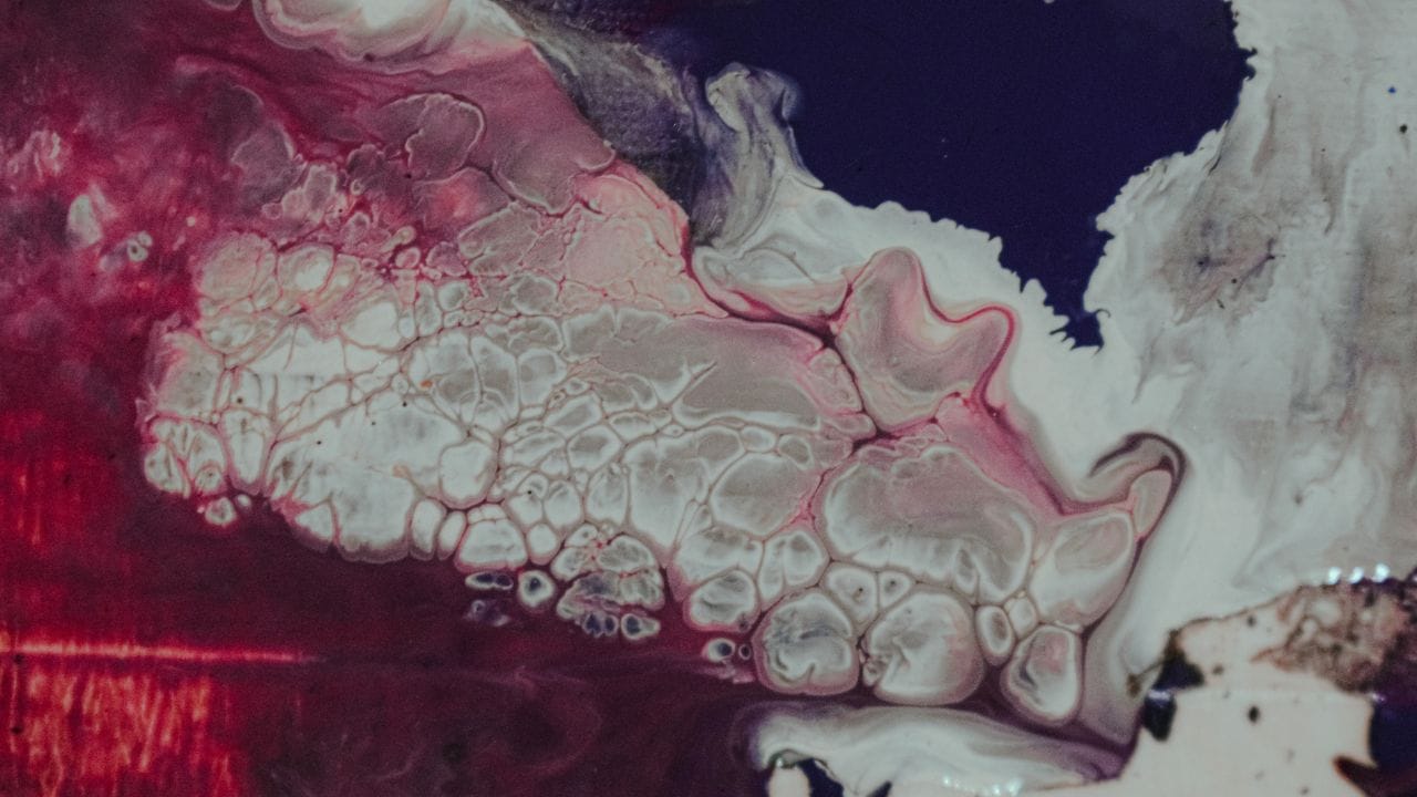 નોંધ : અહીં આપવામાં આવેલી માહિતી ફક્ત આપની જાણકારી માટે છે. કોઈ પણ ઈલાજ કરતાં પહેલા કે,અમલમાં લેતા પહેલા નિષ્ણાતોની સલાહ લેવી જરુરી છે. ( all photo:canva)