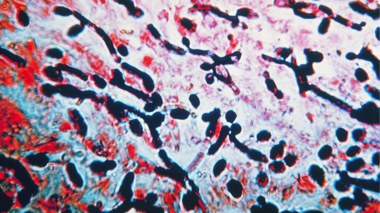 મહિલાઓ ઈન્ટીમેન્ટની સ્વચ્છતા જાળવવી જોઈએ. જો તમને વજાઈનામાં દુખાવો, ઈન્ફેક્શન, ખંજવાળ અથવા અન્ય કોઈ લક્ષણોનો અનુભવ થાય, તો ડૉક્ટરની સલાહ લો.